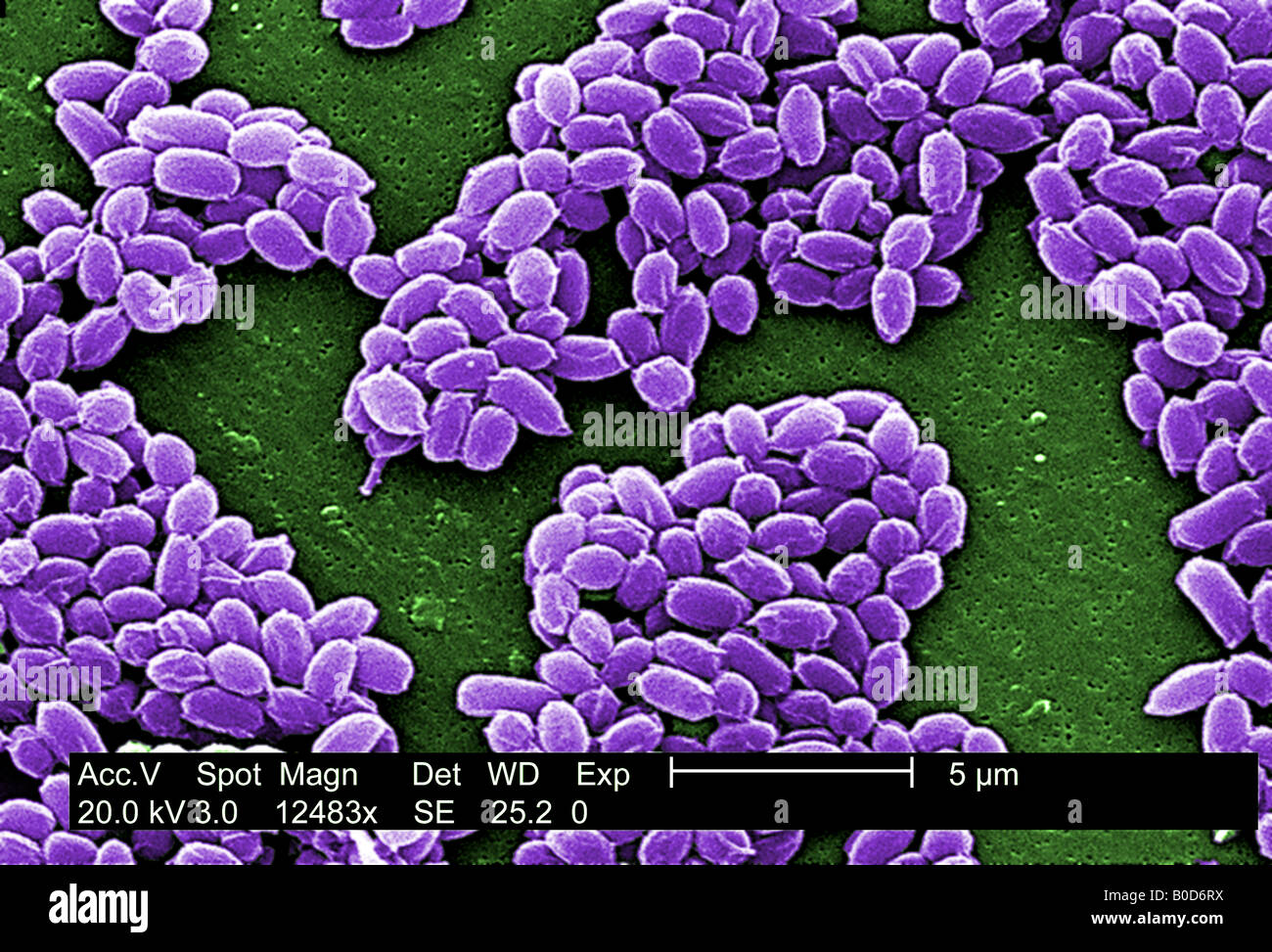 magnification of 12 483X SEM spores from the Sterne strain of Bacillus anthracis bacteria Stock Photo