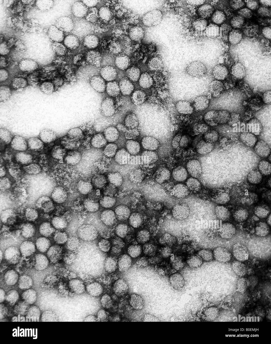 transmission electron microscope image of yellow fever virus Stock Photo