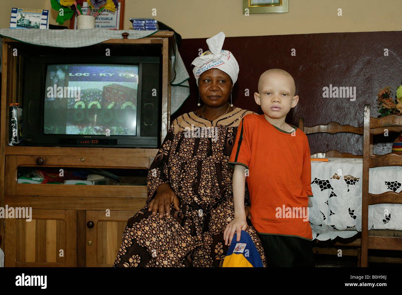 Mother and her albino son beside the television in their living room, Douala, Cameroon, Africa Stock Photo