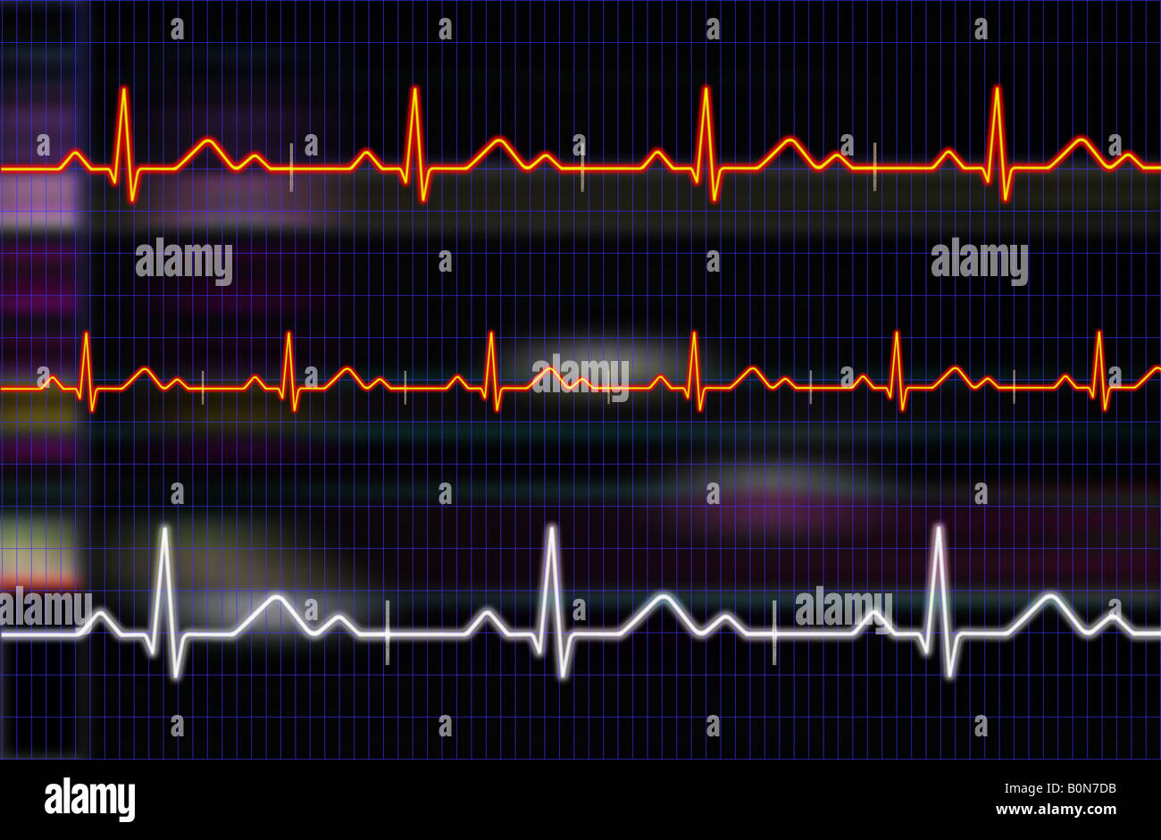 Electrocardiogram conceptual background Stock Photo - Alamy
