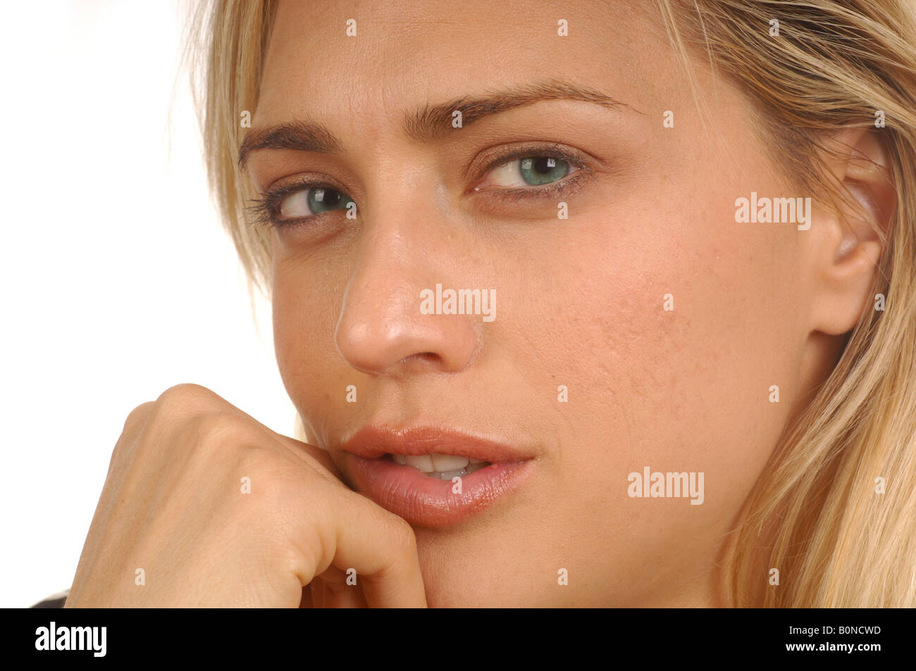 young female face with skin problem Stock Photo