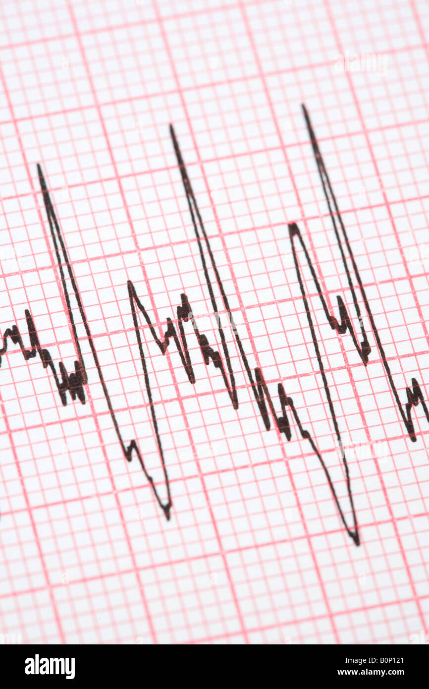 Printout from cardiograph during exercise Stock Photo