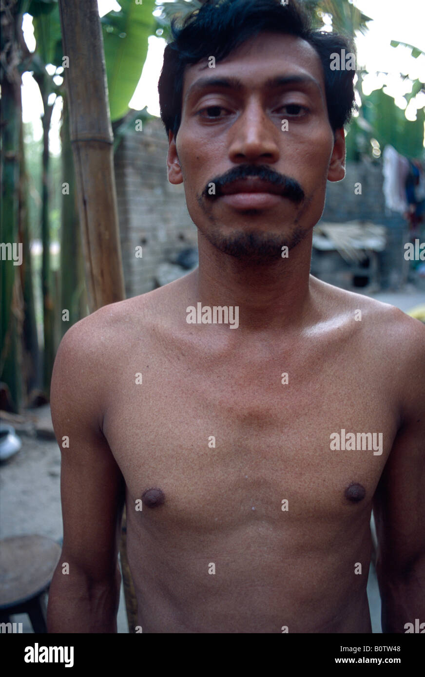 A man stands next to a sealed off water well due to the drinking water being contaminated by arsenic Stock Photo