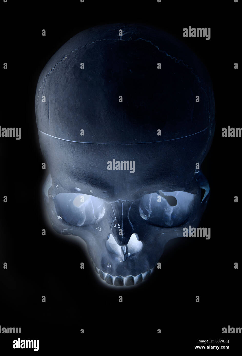Human skull, X-ray image Stock Photo