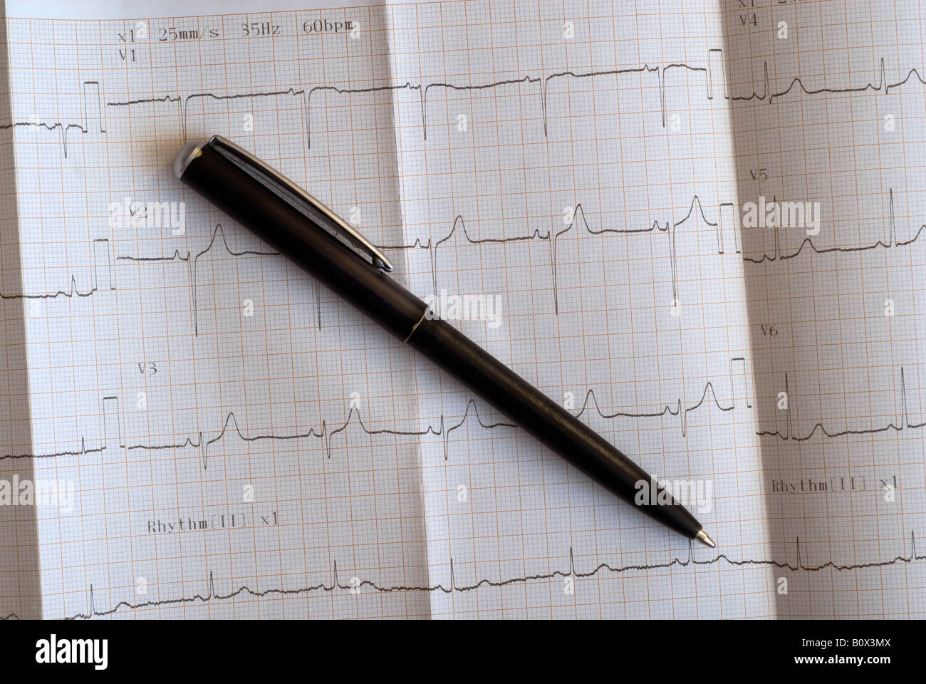 Close up of an electrocardiograph and a pen Stock Photo