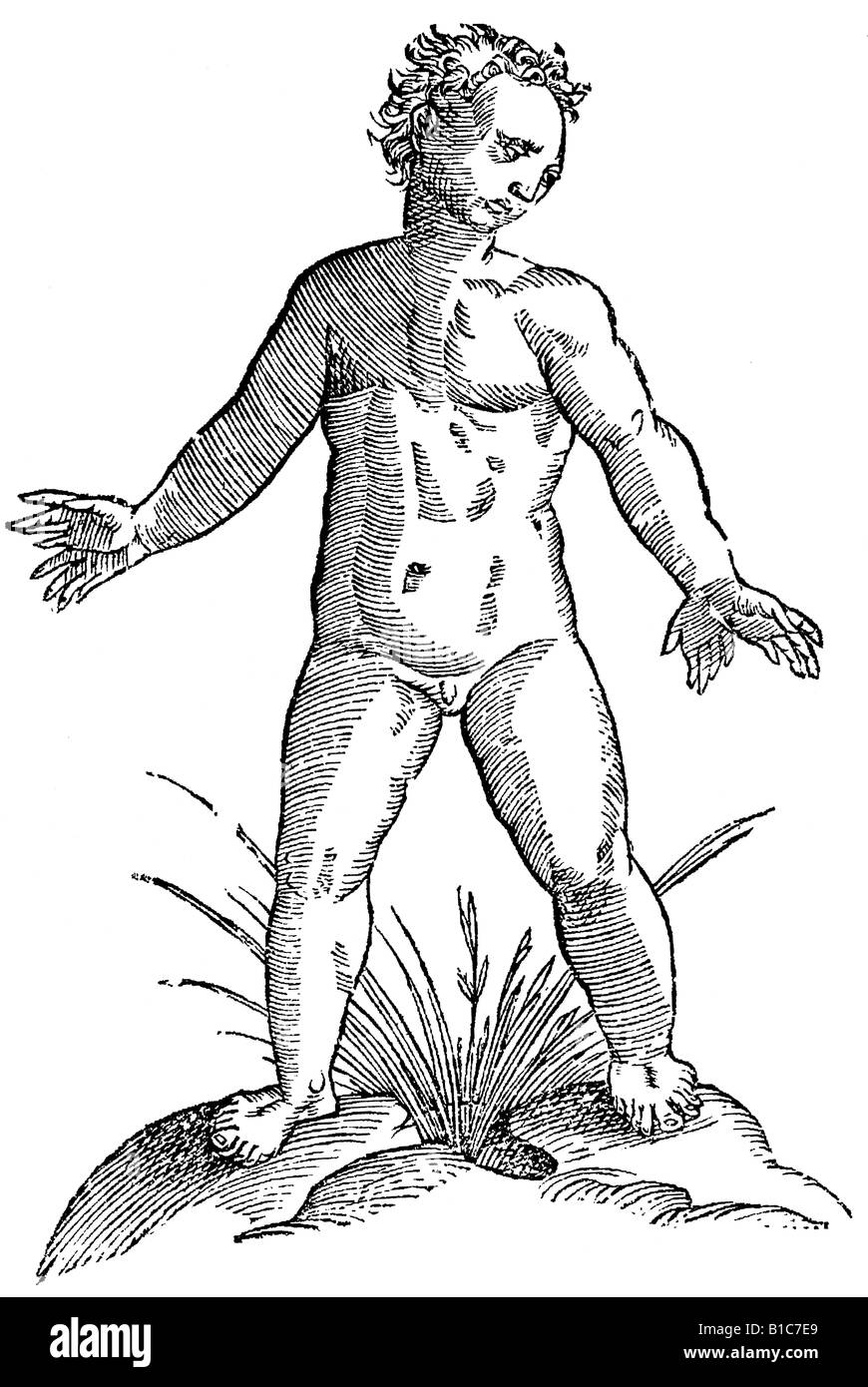 Infans geminatis digitis, Aldrovandi, 1642, 17th century, renaissance, Europe Stock Photo