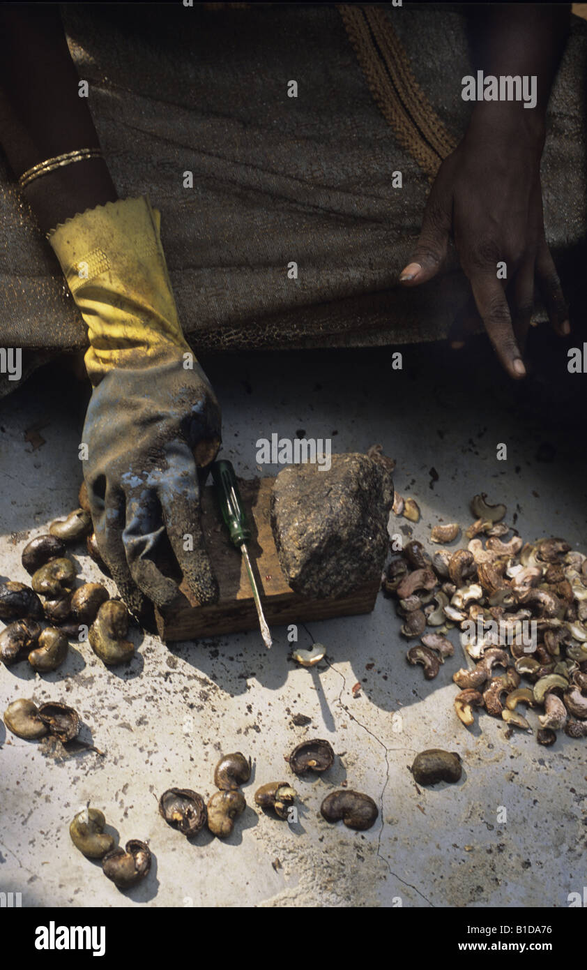 Cashew nut processing The nuts give off an acid which burns the workers