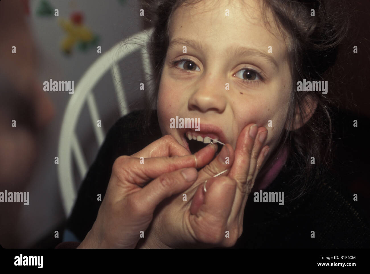 Mother uses dental floss to help extract a loose tooth on a child whose