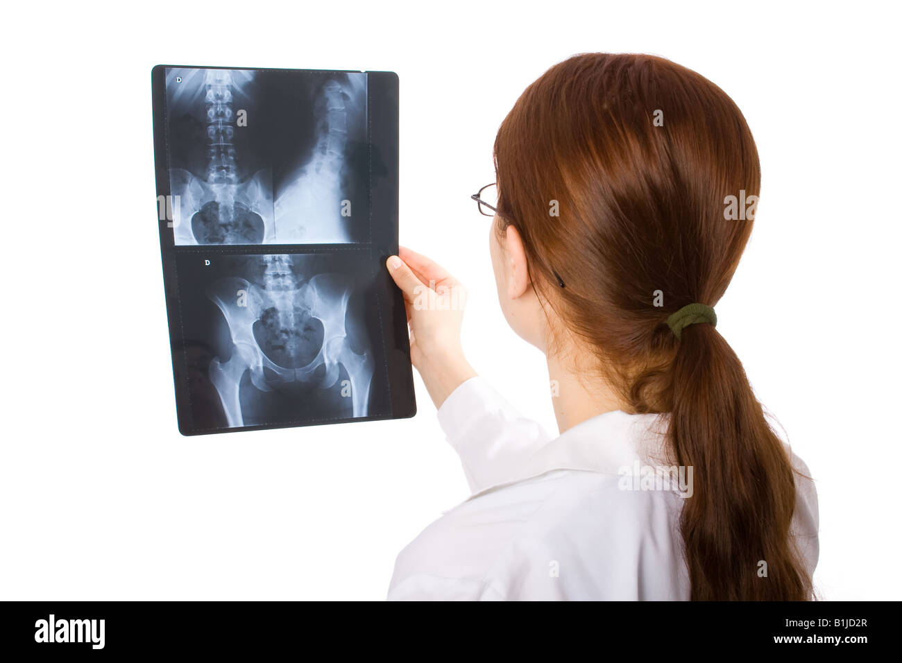 X ray of female pelvis hi-res stock photography and images - Alamy