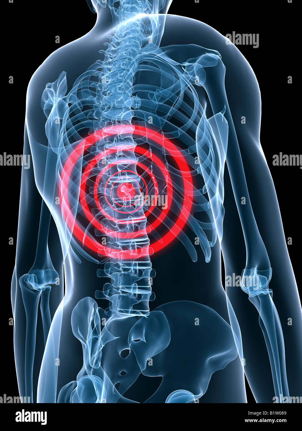 Painful spine hi res stock photography and images Alamy