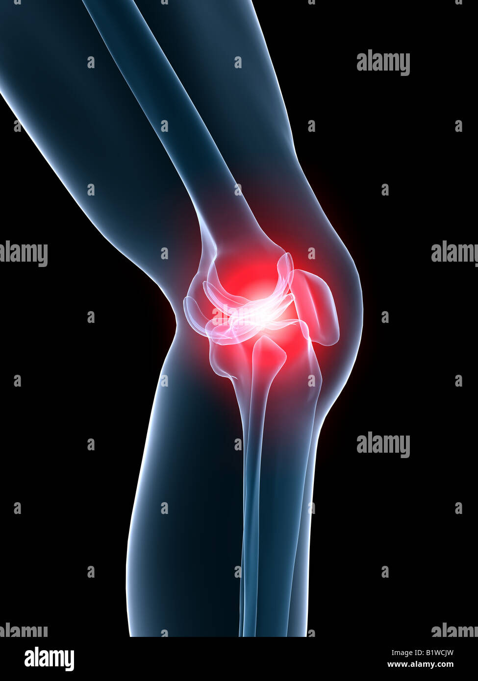 painful knee Stock Photo
