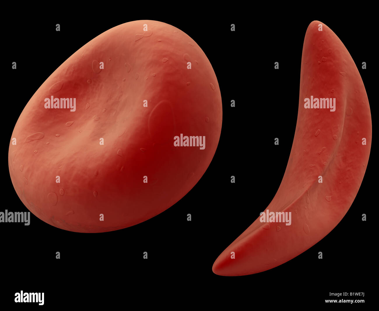 sickle cell Stock Photo