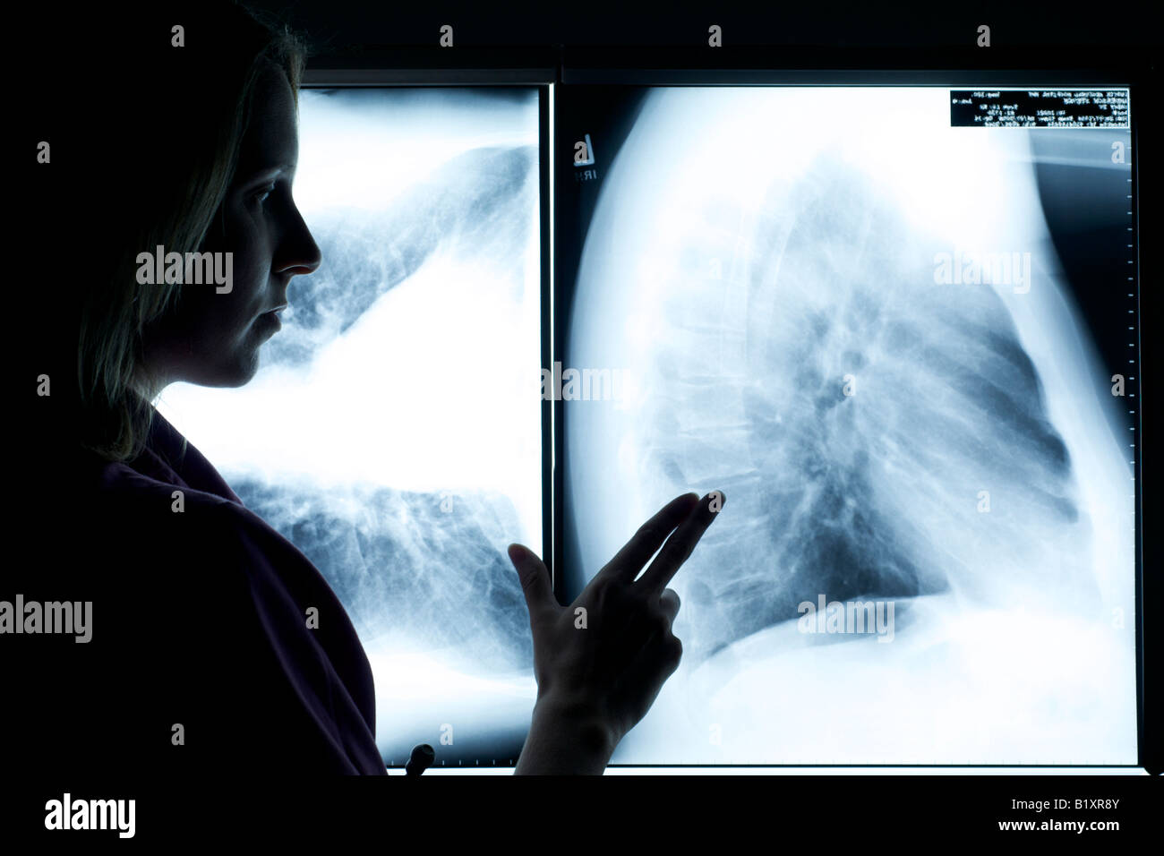 Nurse in scrubs with stethoscope reviewing Xray. Silhouette shot Stock