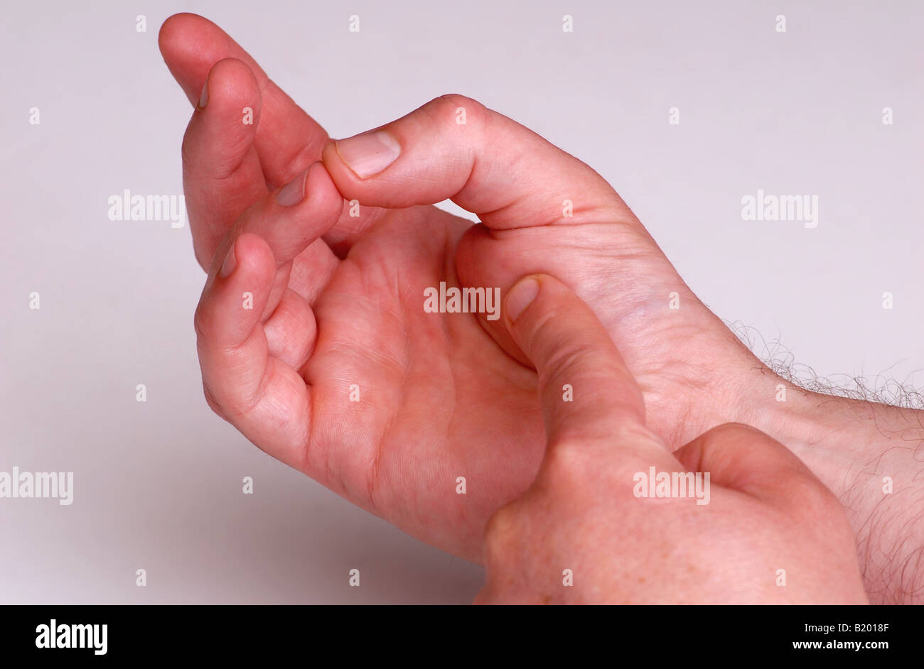 Cooking steak by prodding hand as a test for rare medium or well done