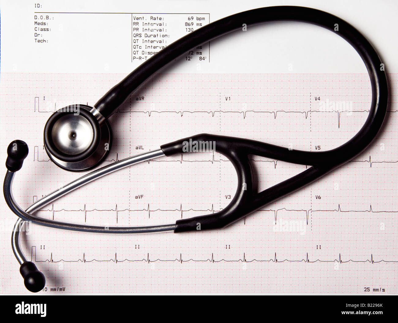 A 12 lead electrocardiogram, or EKG, showing a patients heart rhythm and a stethoscope for listening to the heart Stock Photo