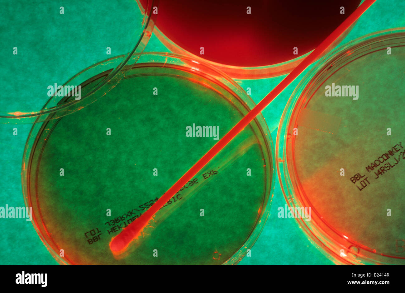 PETRI DISHES USED TO HOLD SOLID CULTURE MEDIA Stock Photo Alamy