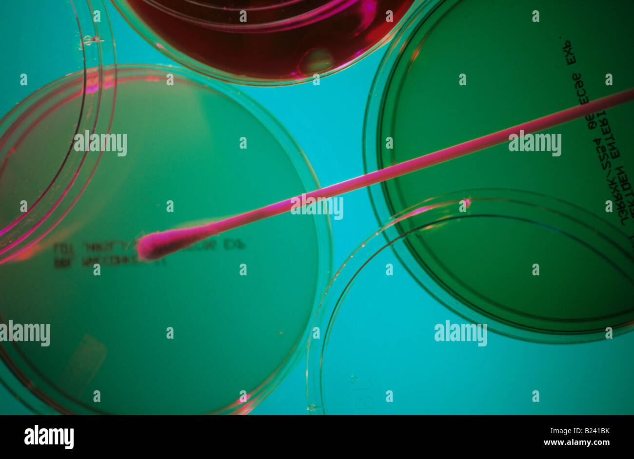 PETRI DISH WITH BLOOD AGAR CULTURE MEDIA Stock Photo - Alamy