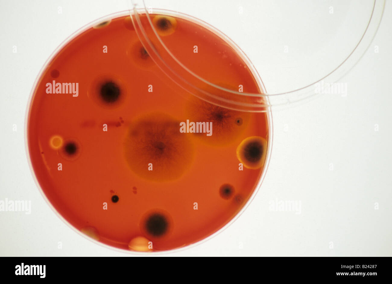 Blood agar hires stock photography and images Alamy