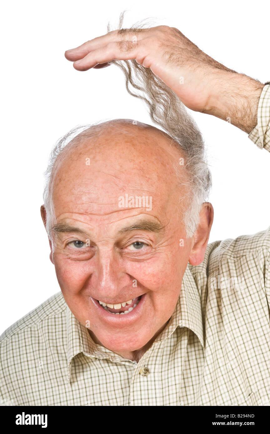 An elderly man displaying his "comb-over" to cover his balding head
