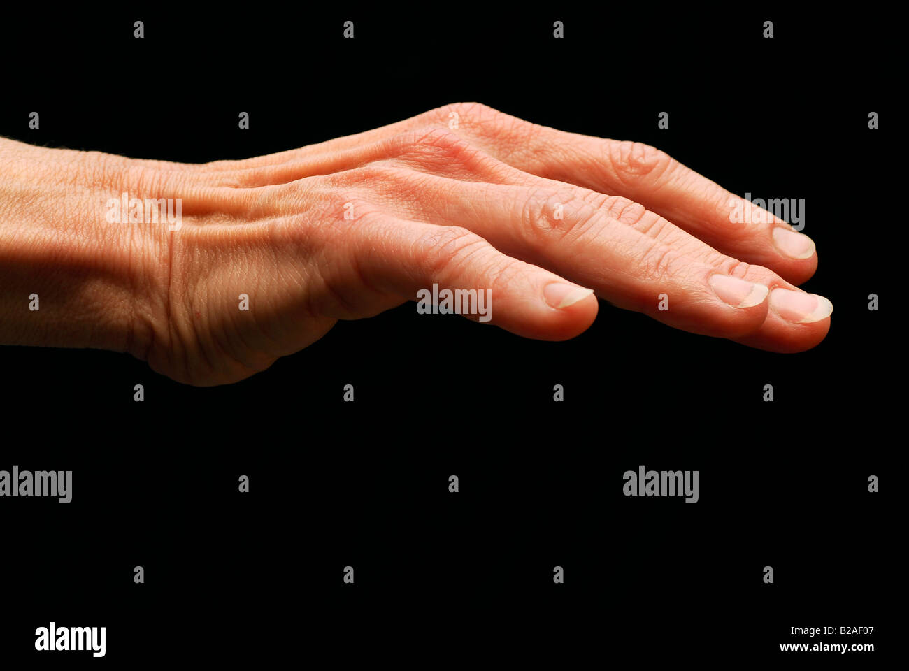 Hand Knuckle Joints Parts