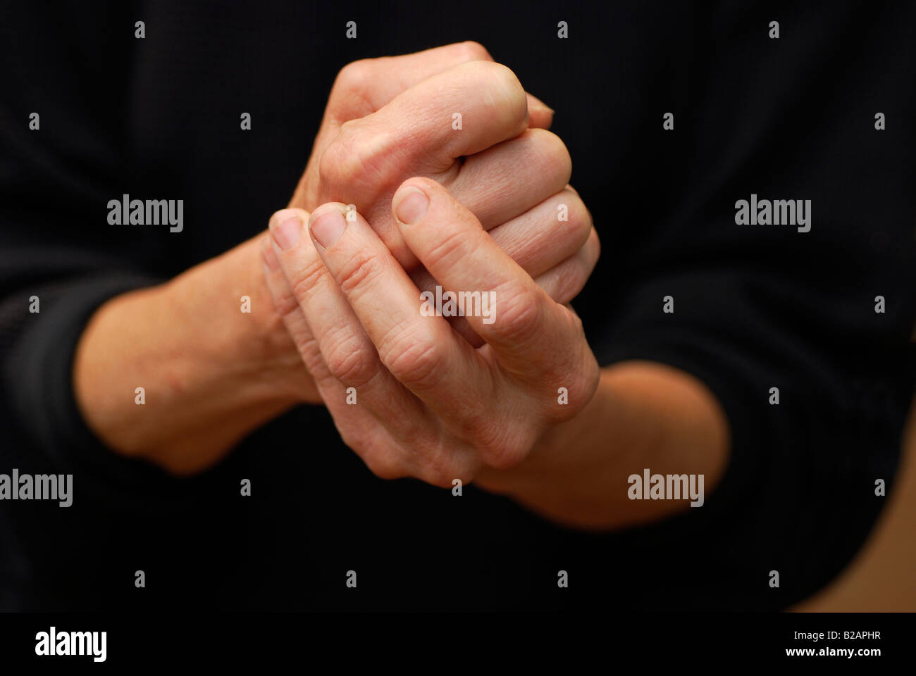59yearold woman's hands, symptoms of arthritis Stock Photo Alamy