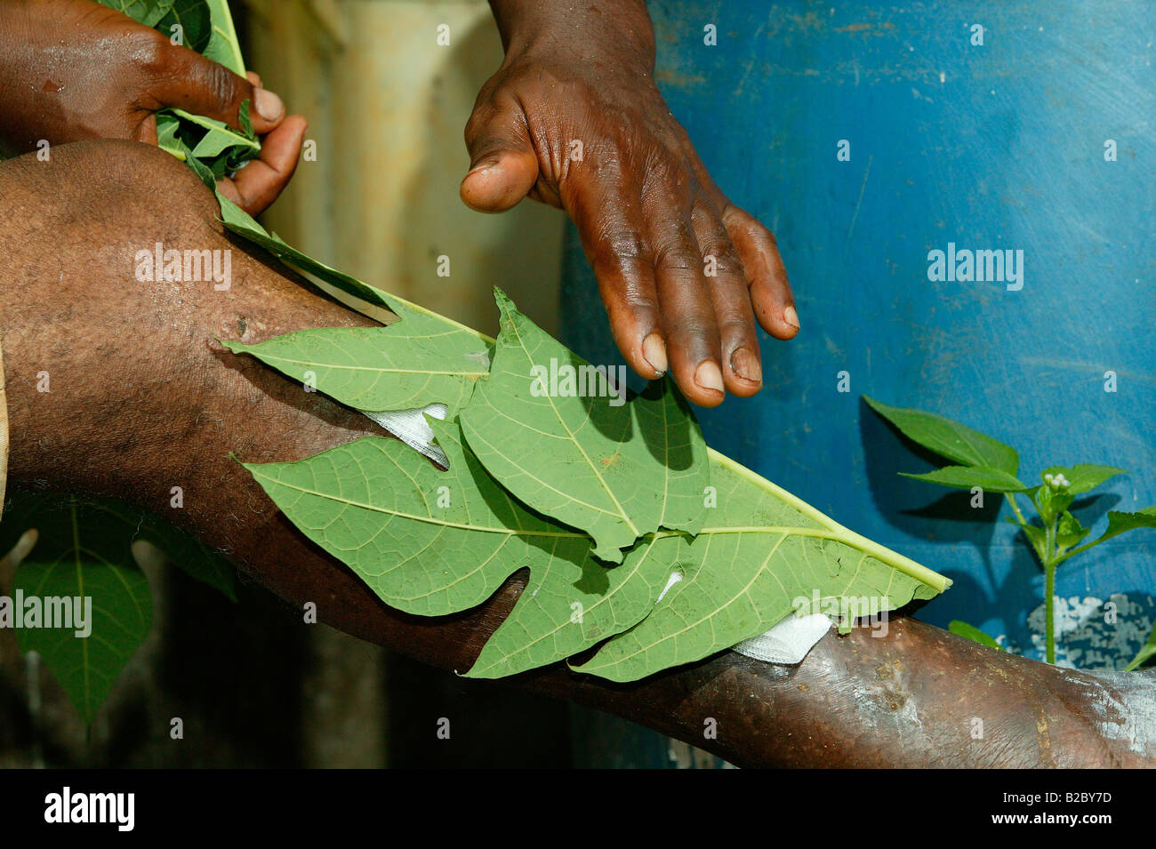 A natural healer treating the bad leg of a patient, Yaounde, Cameroon, Africa Stock Photo