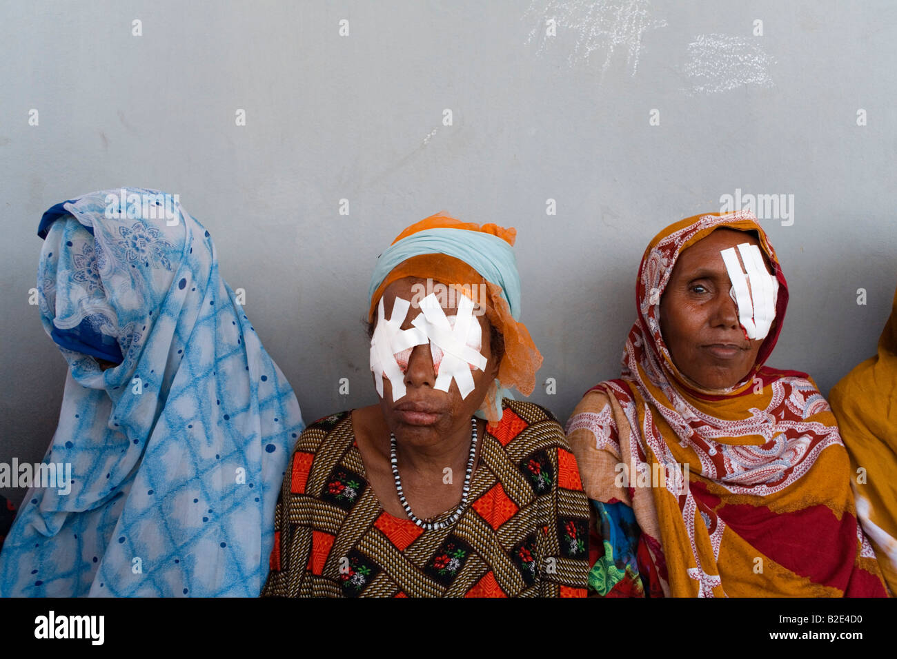 Three women sit outside a rural government health clinic in the Afar region of Ethiopia after undergoing Trachoma operations Stock Photo
