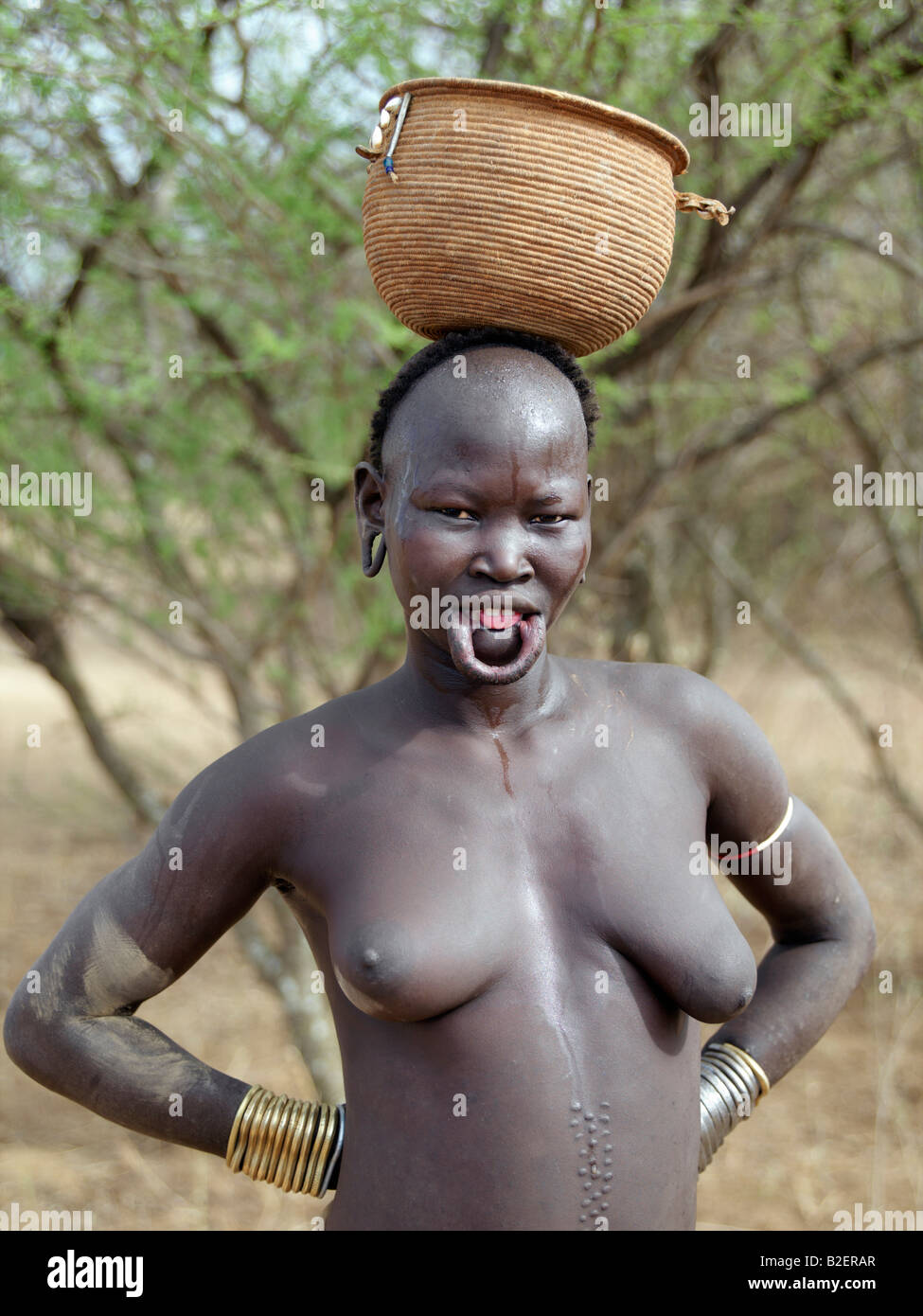 The stretched lower lip of this Mursi woman is unsightly when she takes out her large clay lip plate. Stock Photo
