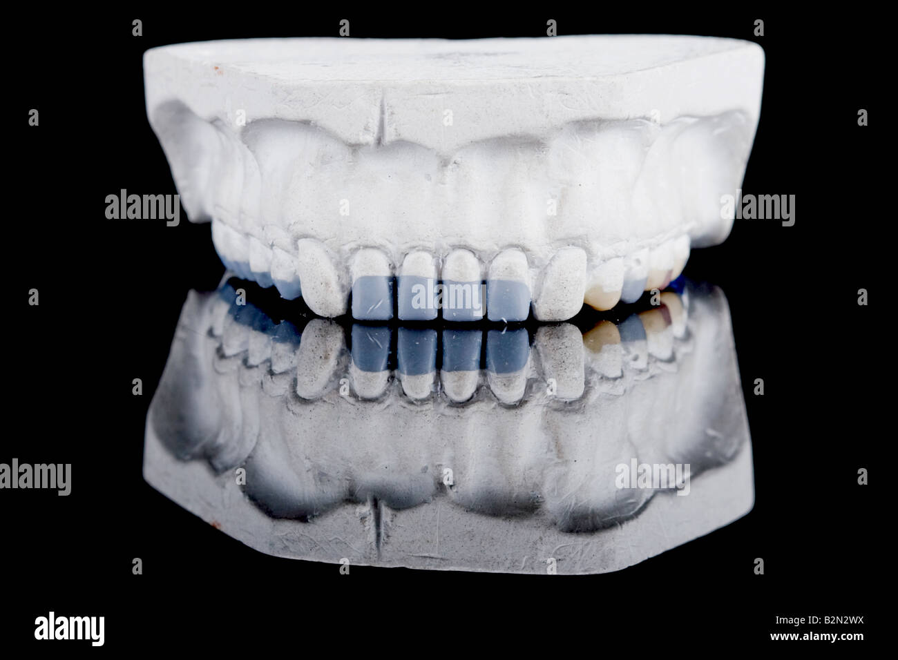 Colorful dental braces or retainer on teeth mold, clay human gums model  Stock Photo - Alamy