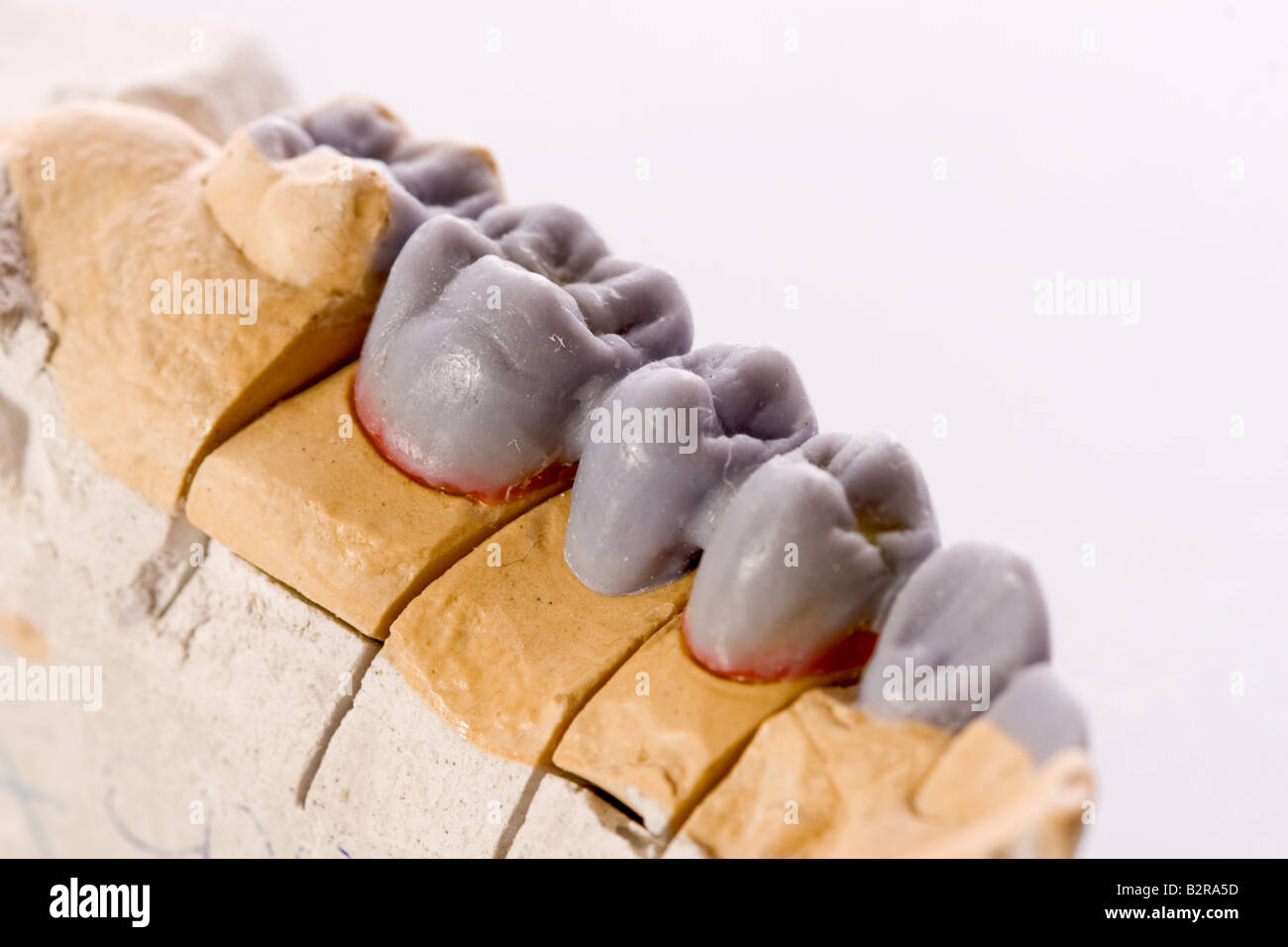 gypsum model of a human teeth on white background Stock Photo