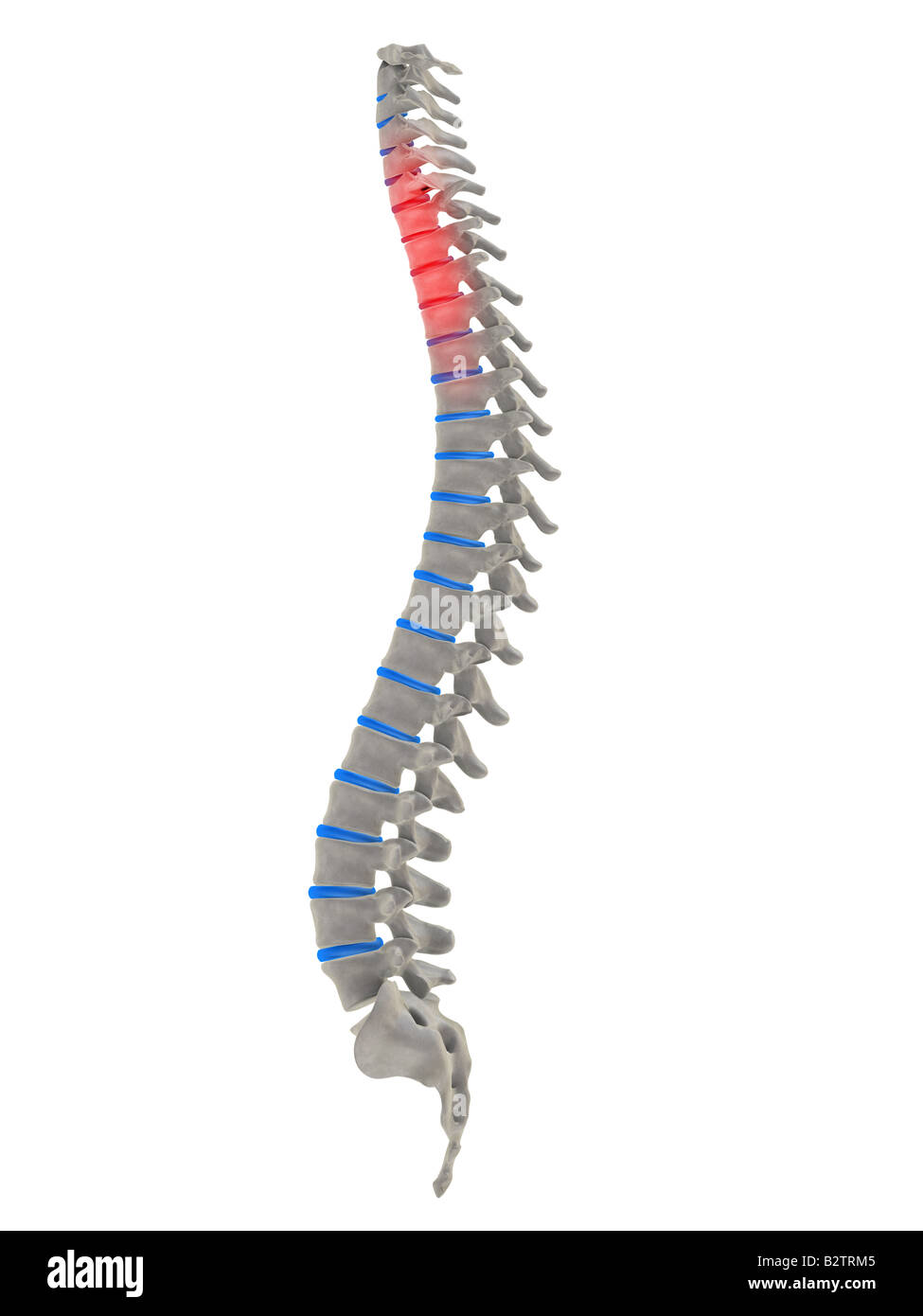 Dead vertebra spine hires stock photography and images Alamy