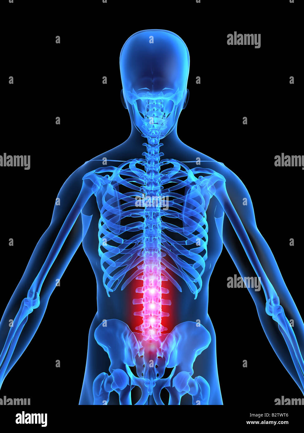 Lower Back Inflammation Stock Photo Alamy