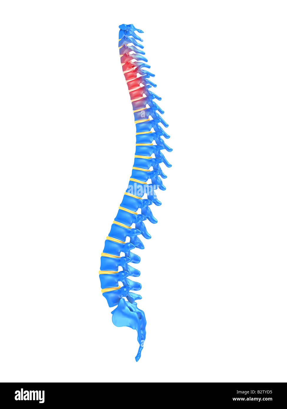 Human spine pain hi-res stock photography and images - Alamy