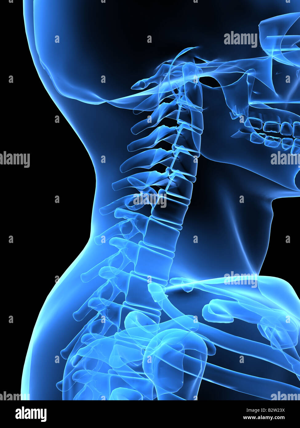 Head and neck x ray hires stock photography and images Alamy
