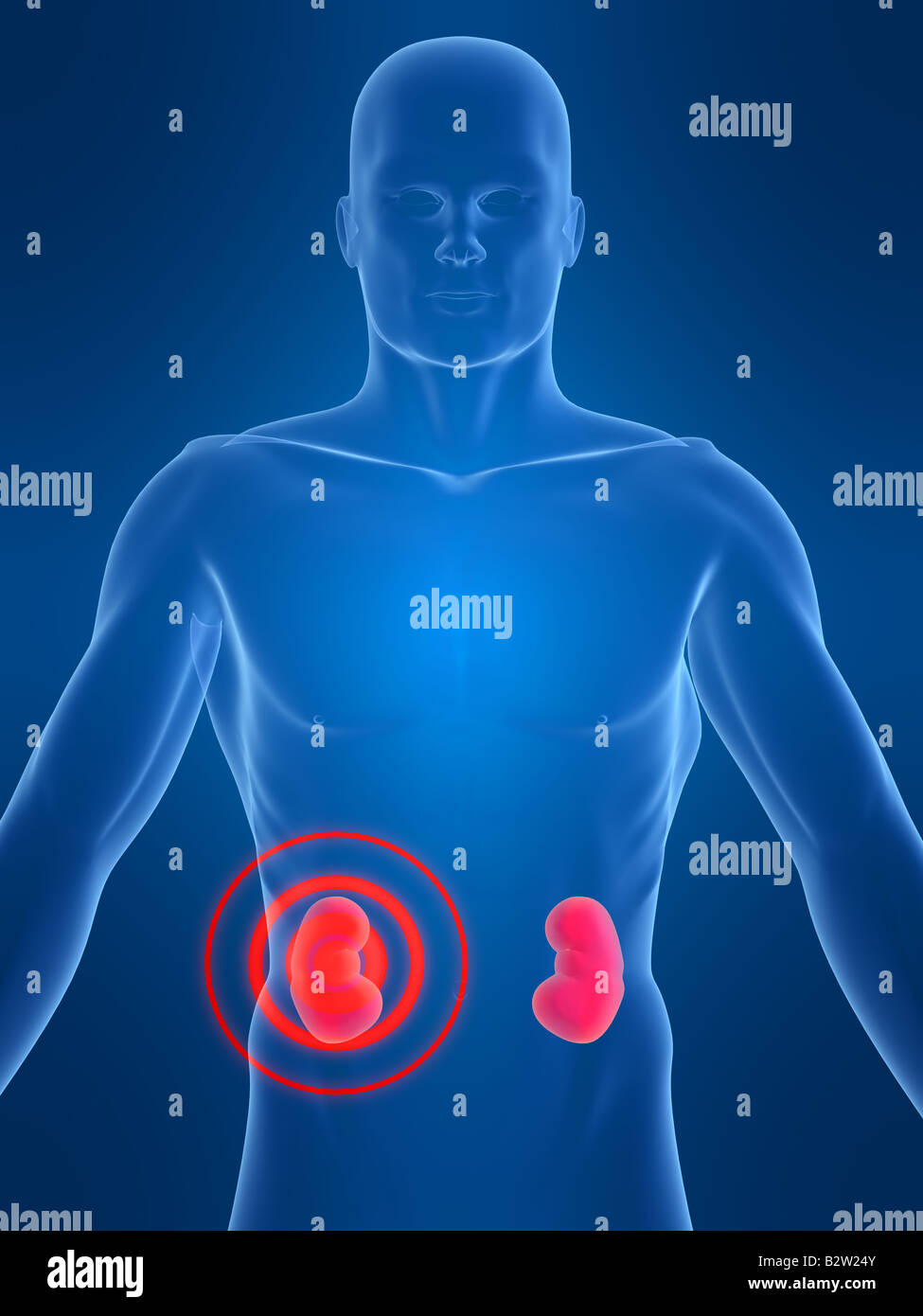 Kidney cortex hires stock photography and images Alamy