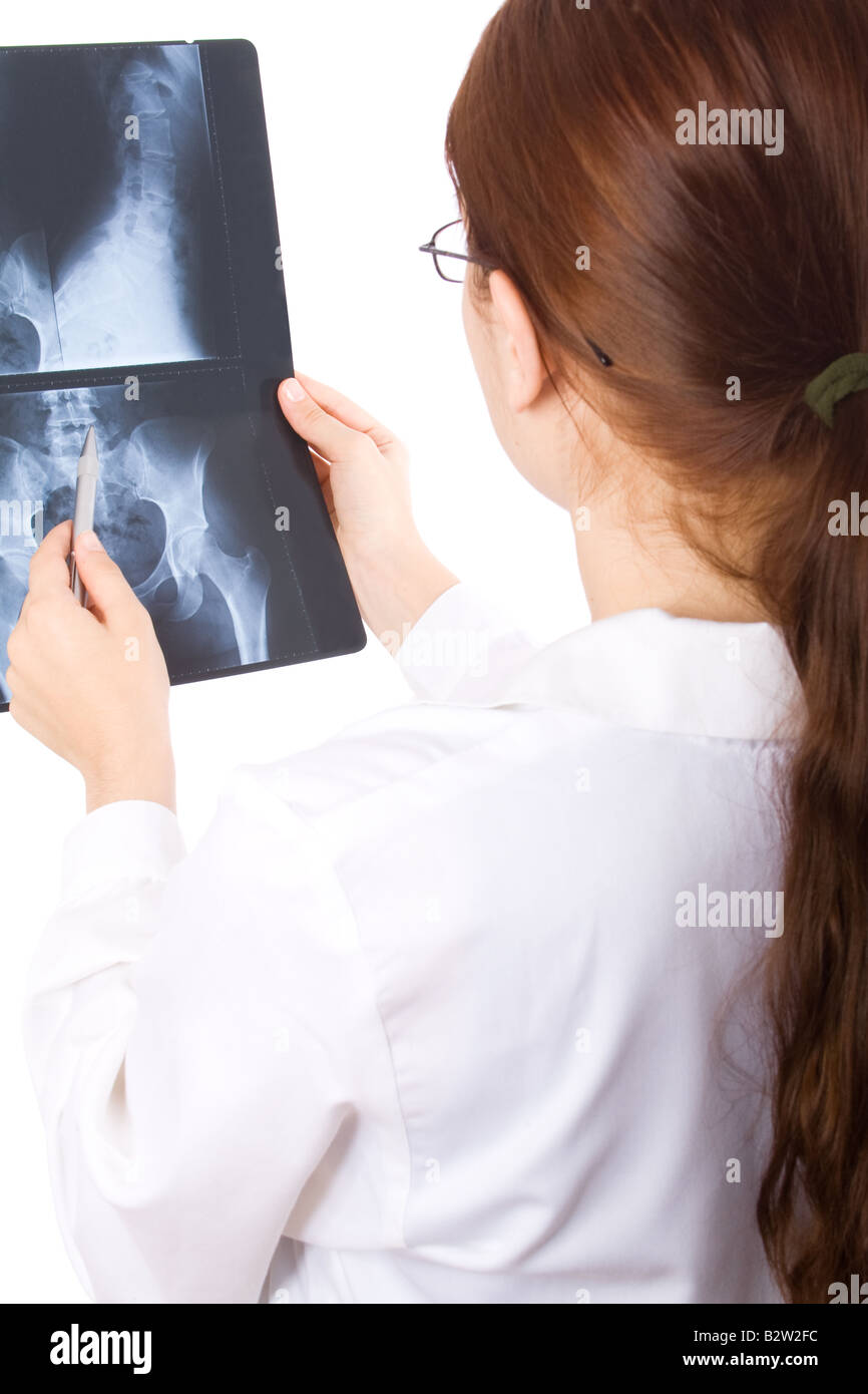 Female doctor examining a pelvis x-ray Stock Photo