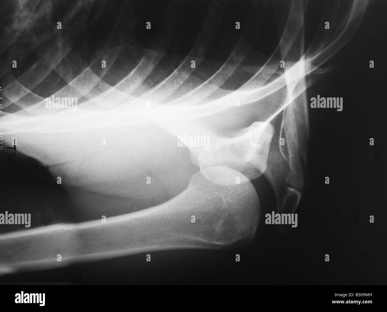 X ray of human shoulder Stock Photo Alamy