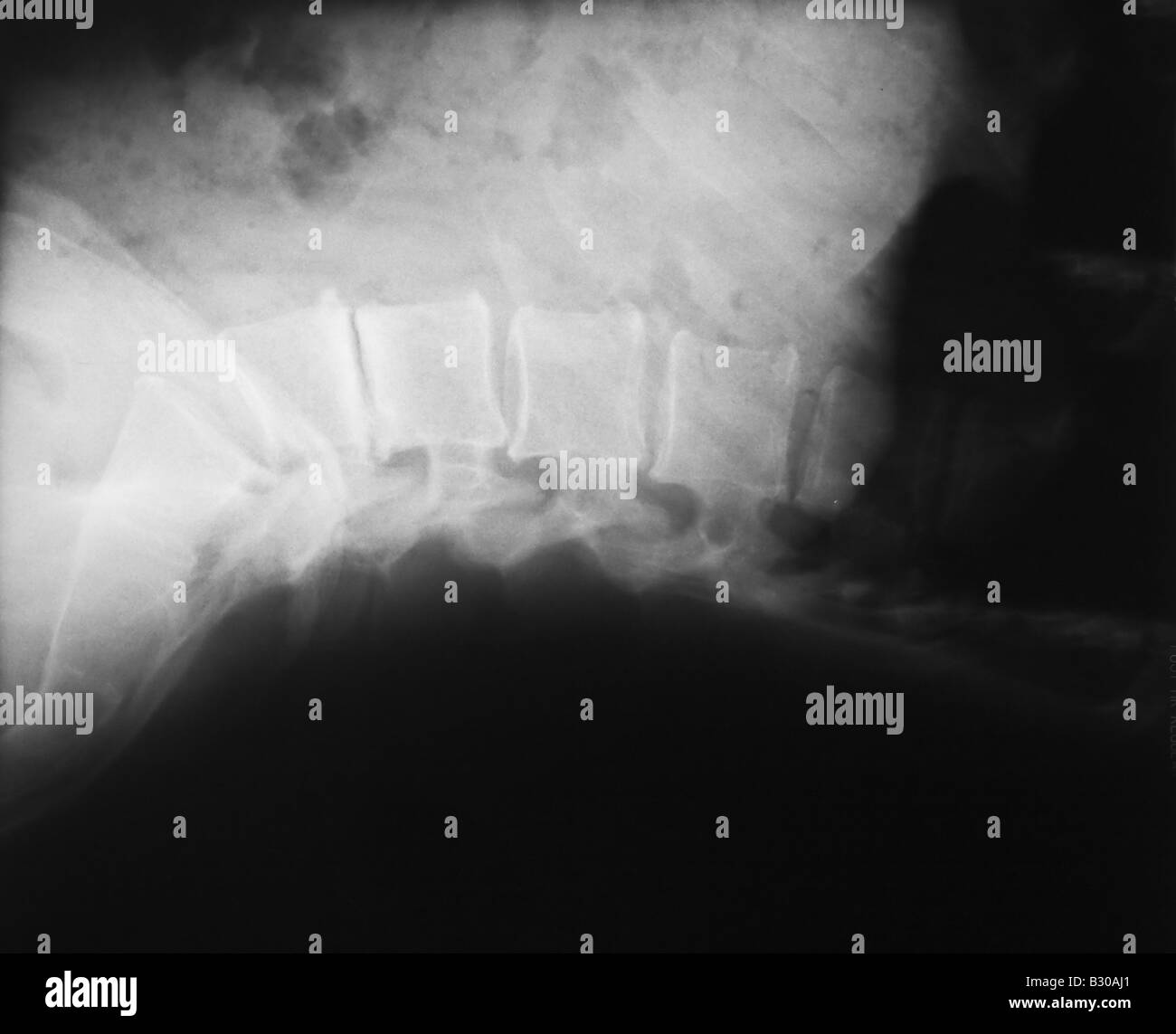 Human lumbar spine hi-res stock photography and images - Alamy