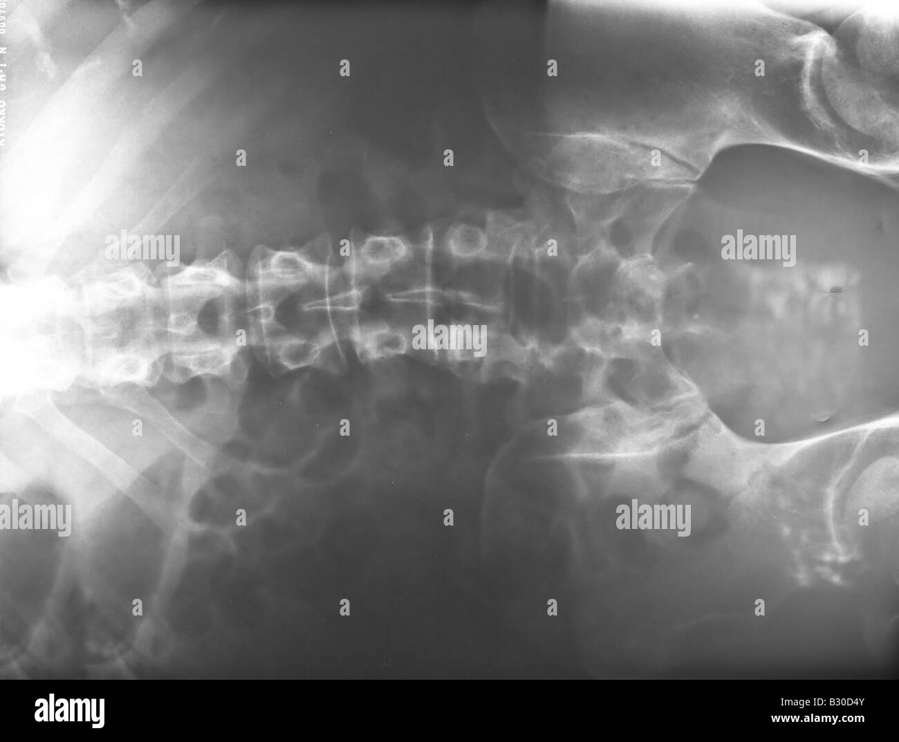 X ray of human lumbar spine Stock Photo - Alamy