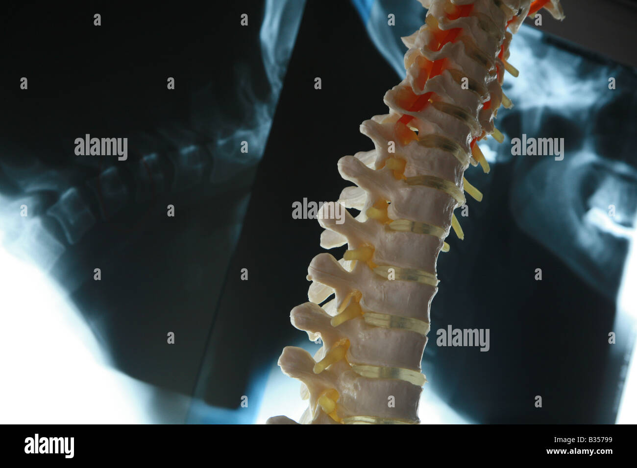 Xray of the lumbar spine hi-res stock photography and images - Alamy