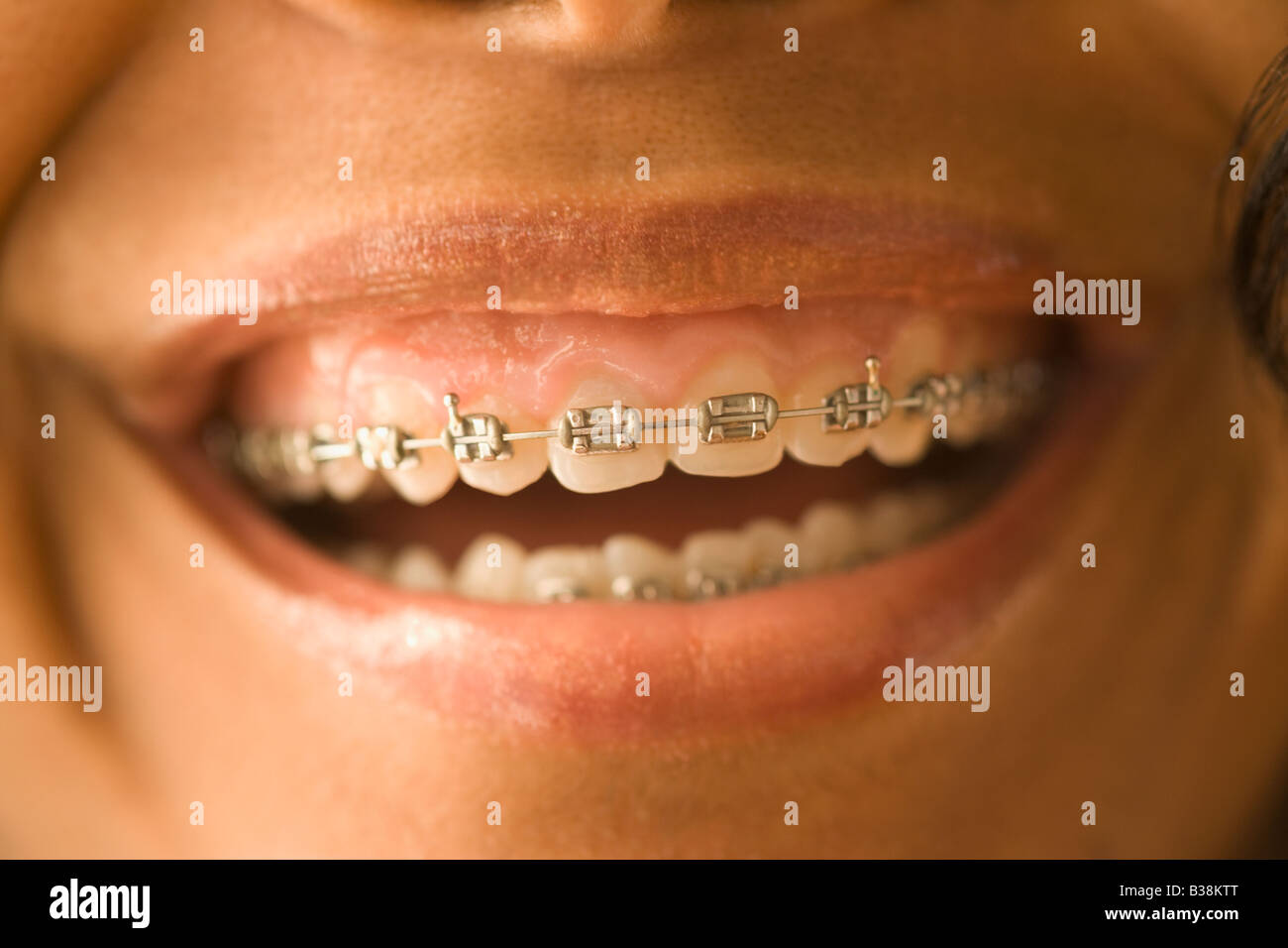 Ethnicity orthodontic hires stock photography and images Alamy