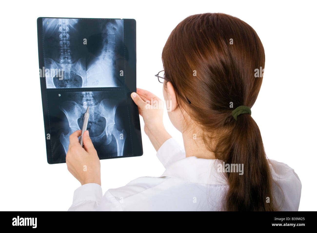 Female doctor examining a pelvis x-ray on white background. ///  Woman examine looking pelvic x ray cut out cutout Spine hips femur Spinal backbone Stock Photo