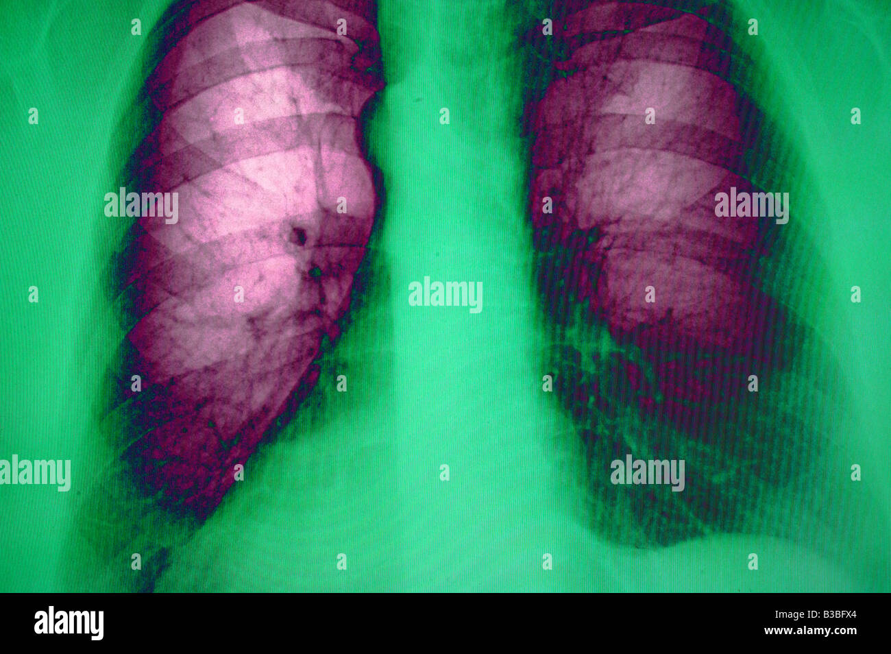 colored coded chest xray male Stock Photo Alamy