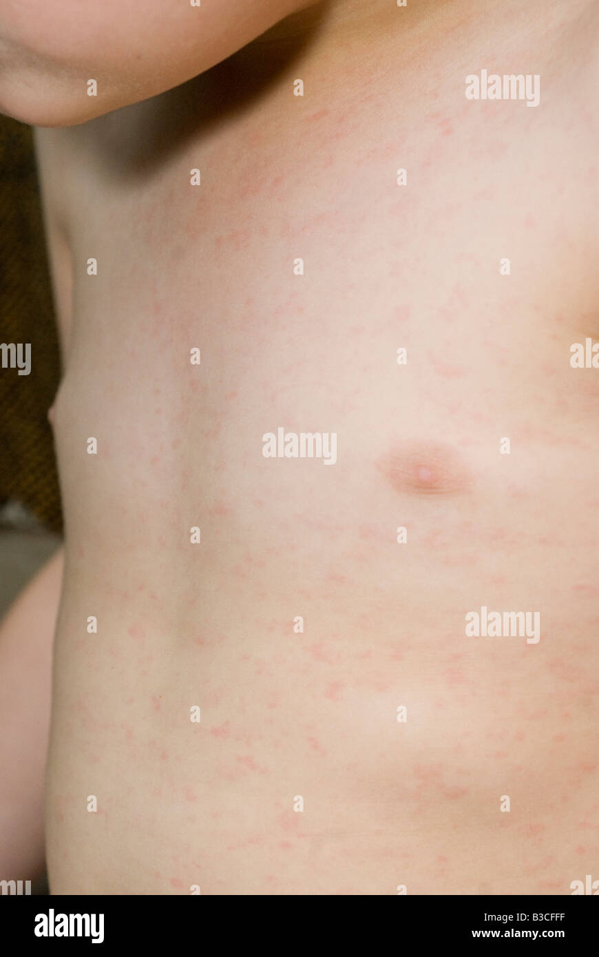 Child Belly Button Not Pregnant High Resolution Stock Photography and ...