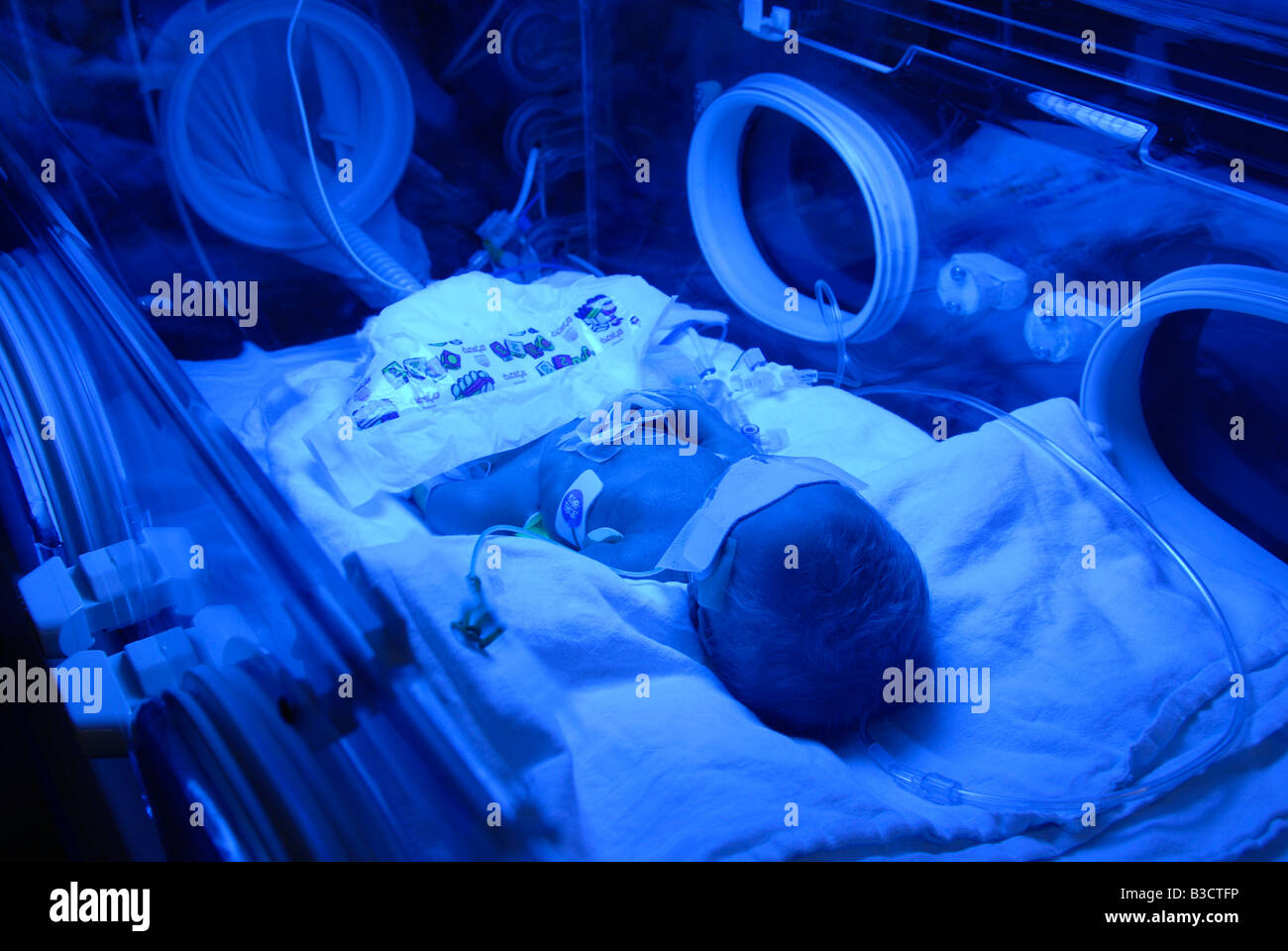 A premature baby inside incubator device at the neonatal intensive care unit in Shaare Zedek Medical Center or Shaarei Tzedek hospital, West Jerusalem Stock Photo