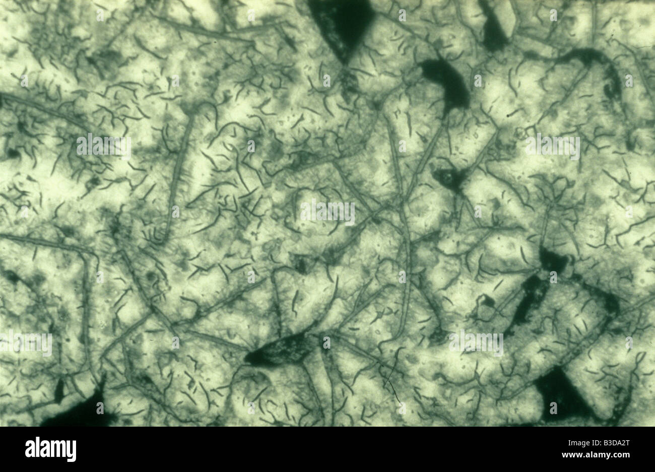 micrograph of pig iron or cast iron which contains crystals of carbon - high carbon content Stock Photo