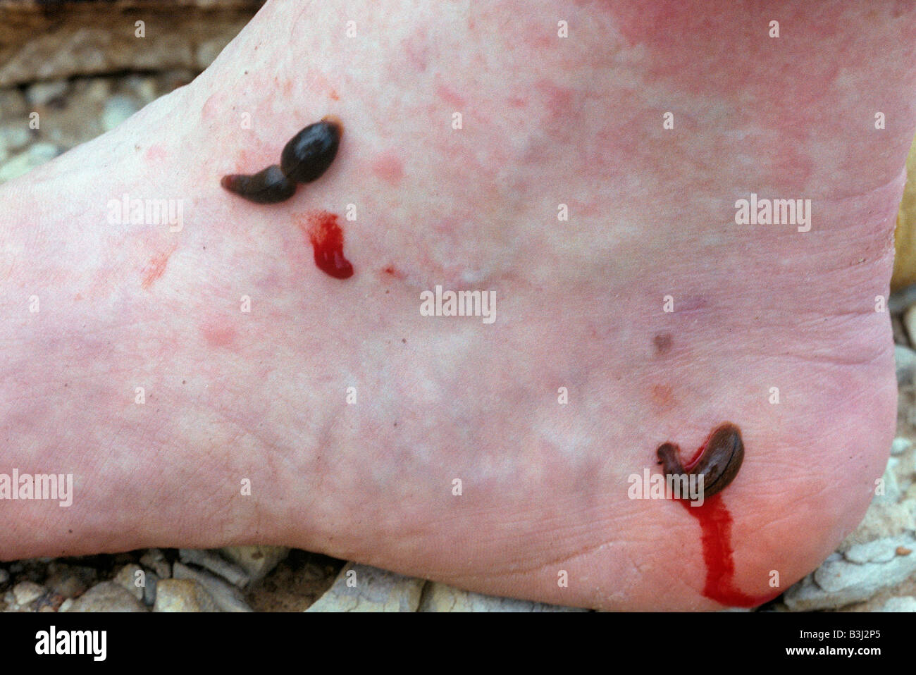 Blood worms hi-res stock photography and images - Alamy