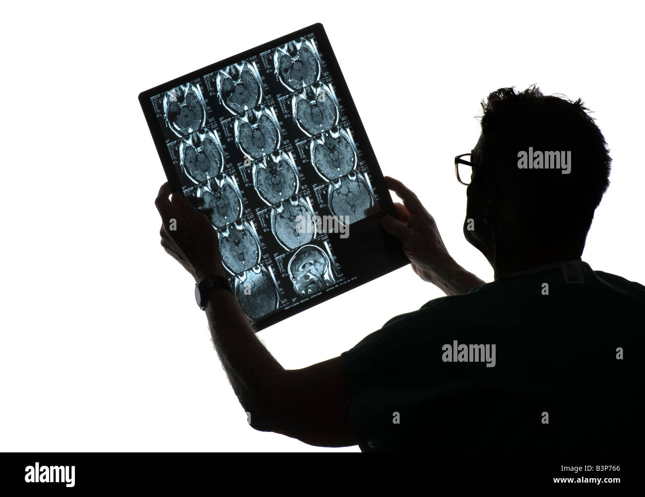 silhouette of doctor examining MRI x-ray Stock Photo