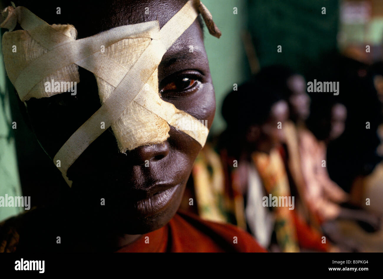 Hutu villagers at mission clinic in munanira, woman with bandaged machete wound across her face Stock Photo