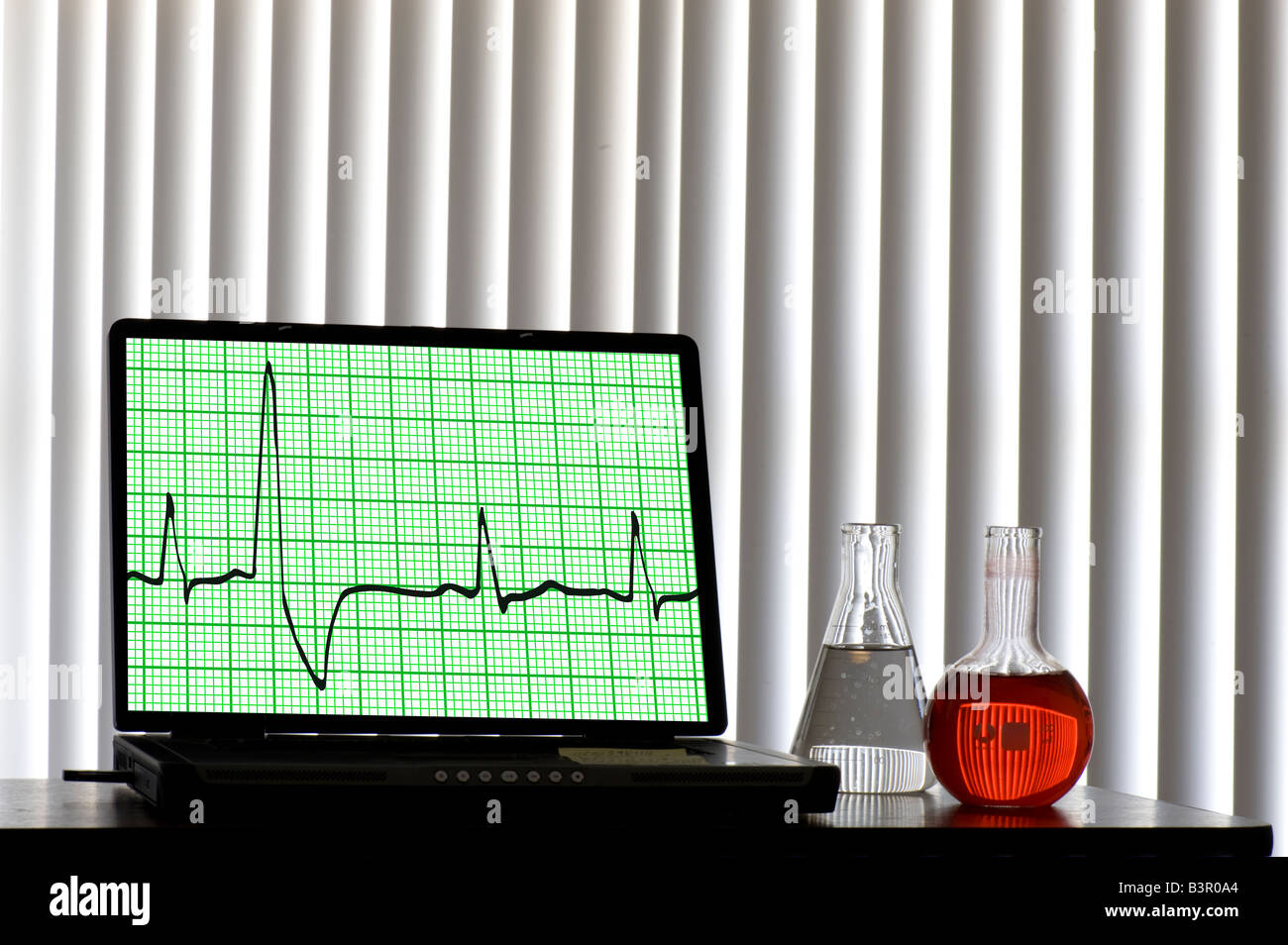 EKG Electrocardiogram displayed on laptop computer Stock Photo